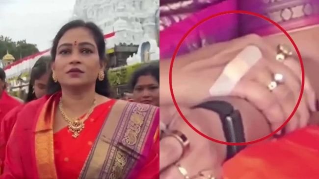 తిరుపతి డ్రోన్ ప్రమాదంలో ఏపీ హోం మంత్రి అనితకు స్వల్ప గాయం