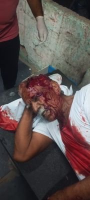 వ్యక్తిపై దాడి 