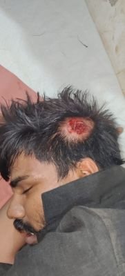యువకుడి పై దాడి.... తీవ్ర గాయాలు