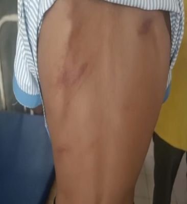 పరీక్షలో జవాబు రాయలేదని విద్యార్థిపై టీచర్‌ దాడి!