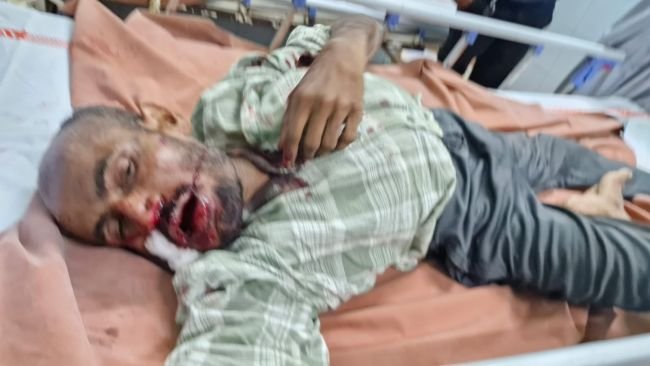 ఆగి ఉన్న ట్రాక్టర్ ను ఢీకొన్న దివ్యాంగుడు   - బాధితుడి పరిస్థితి విషమం