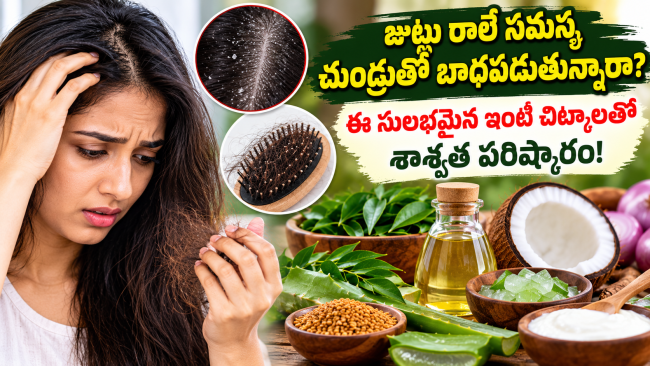 జుట్టు రాలే సమస్య, చుండ్రుతో బాధపడుతున్నారా? ఈ సులభమైన ఇంటి చిట్కాలతో శాశ్వత పరిష్కారం!