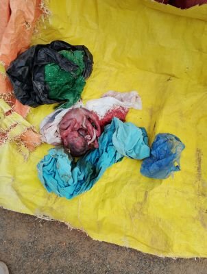 చెత్త బుట్టలో మృత శిశువులభ్యం