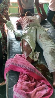 భైరగులపాడు వద్ద ఘోర రోడ్డు ప్రమాదం: వ్యక్తికి తీవ్ర గాయాలు