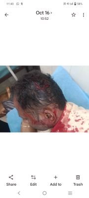 వైసిపి టిడిపి మధ్య పరస్పర దాడులు!