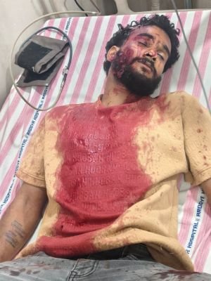 చల్‌గల్‌లో యువకుడిపై కత్తితో దాడి.. పరిస్థితి విషమం