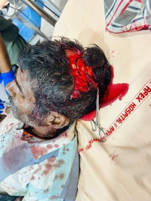 ఎలుగుబంటి దాడిలో వ్యక్తికి తీవ్ర గాయాలు