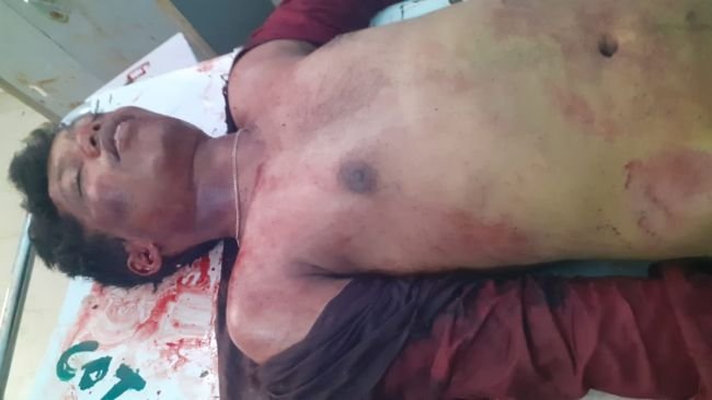 రోడ్డు ప్రమాదంలో యువకుడి మృతి