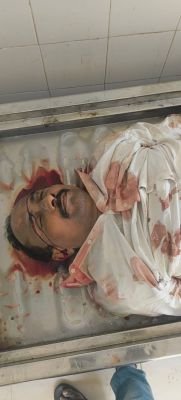 రోడ్డు ప్రమాదంలో వ్యక్తి దుర్మరణం  కుక్క అడ్డురావడంతో స్కూటీపై నుంచి పడి మృతి