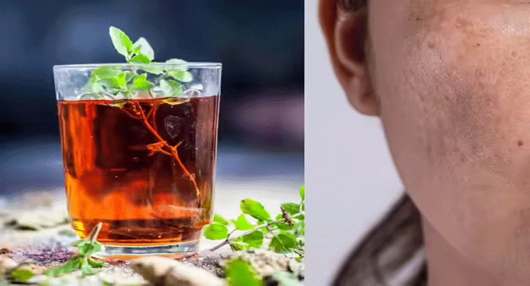 ఈ డ్రింక్ తాగితే పిగ్మెంటేషన్ మాయం, ఎలా చేసుకోవాలంటే