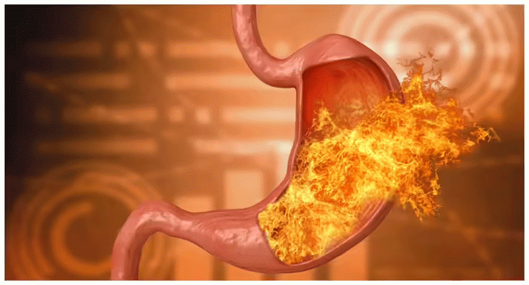 తినగానే గుండెల్లో మంటగా అనిపిస్తుందా,,,,ఇలా చేస్తే రిలాక్స్‌గా ఫీల్ అవుతారు