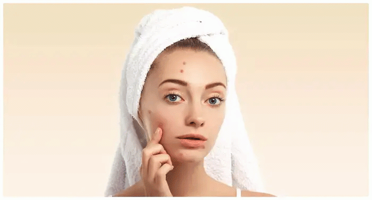 ముఖంపై నల్లమచ్చల్ని తగ్గించే జాజికాయ పొడి,