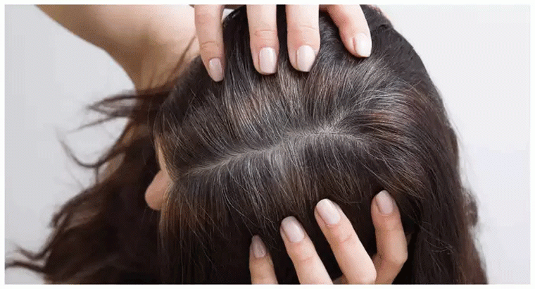 షాంపూ తర్వాత ఇలా చేస్తే తెల్ల జుట్టు కాస్తా నల్లగా మారుతుంది