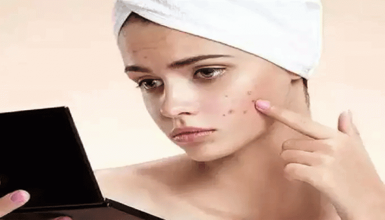 ఐస్ క్యూబ్స్ తో ఇలా రుద్దితే,,,మొటిమలు తగ్గుతాయి..
