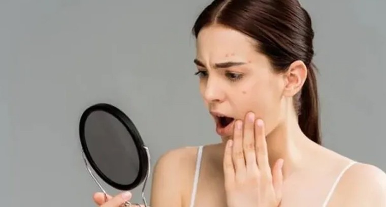 వర్షాకాలంలో మీ చర్మం జిడ్డుగా మారుతోందా?
