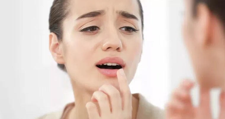 నోటి పూత తగ్గించుకునే మార్గాలివే
