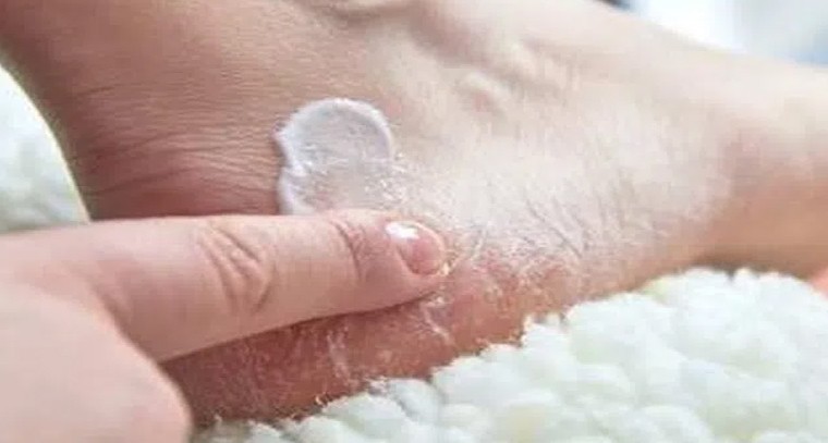 కలలో ఈ పండ్లు కనిపిస్తే శుభప్రదం
