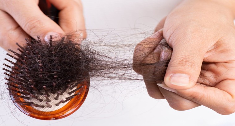 జుట్టు రాలే సమస్యకు చెక్ పెట్టండిలా
