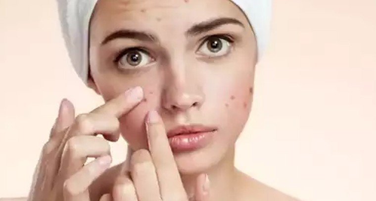 నల్ల మచ్చలను పోగొట్టే చిట్కా మీకోసం
