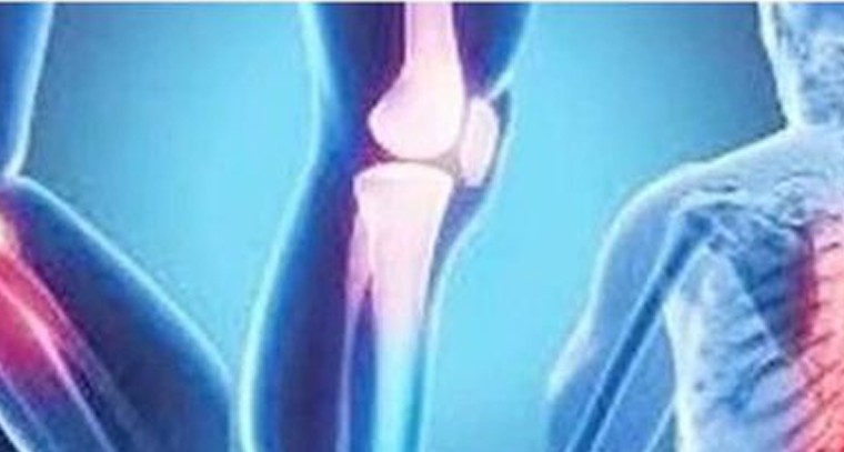 బలమైన ఎముకల కోసం ఇలా చేయండి
