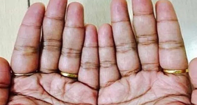 అరచేతిలో అర్ధ చంద్రాకారం ఉంటే.?
