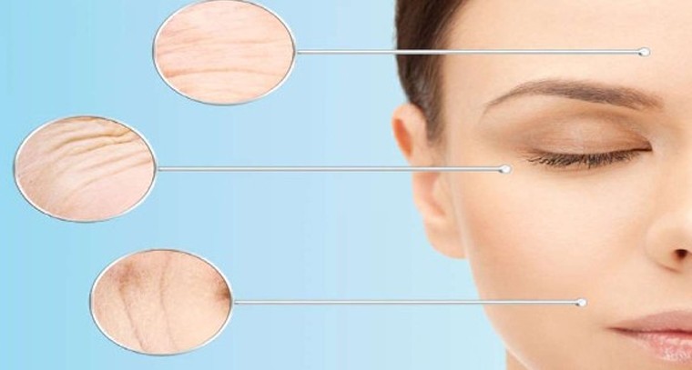 ముఖంపై ముడతలకు ఇలా చెక్ పెట్టండి
