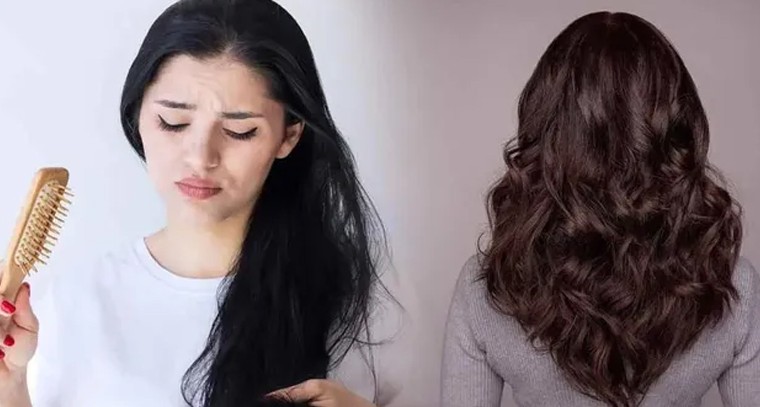 జుట్టు రాలే సమస్యలకు చెక్ పెట్టండిలా
