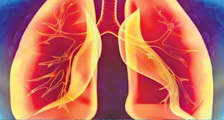 లంగ్స్ ప్రాబ్లమ్స్ తెలిపే లక్షణాలివే!
