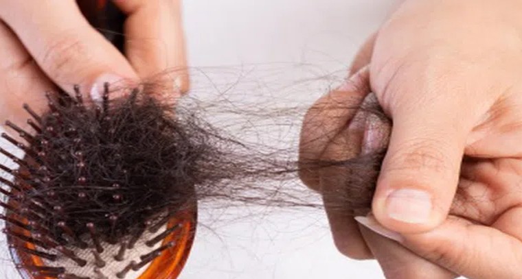 హెయిర్ ఫాల్ సమస్యకు పరిష్కారమిదే.!
