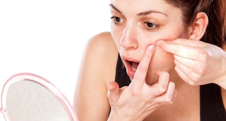 మొటిమలకు చెక్ పెట్టండిలా
