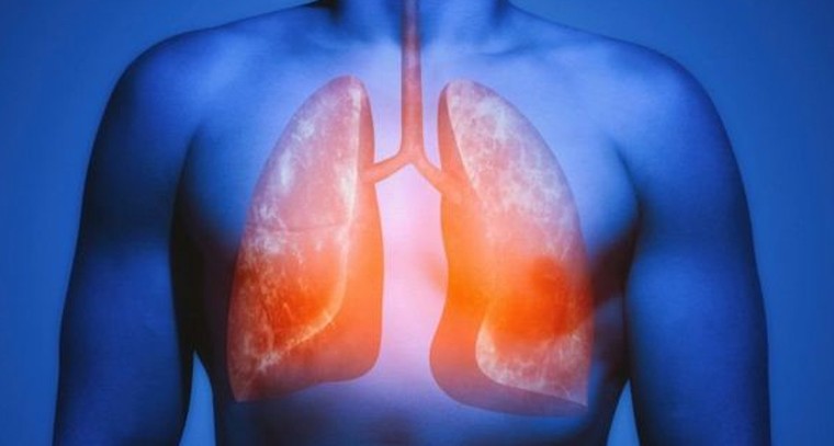 ఊపిరితిత్తులను శుభ్రం చేసుకోండిలా
