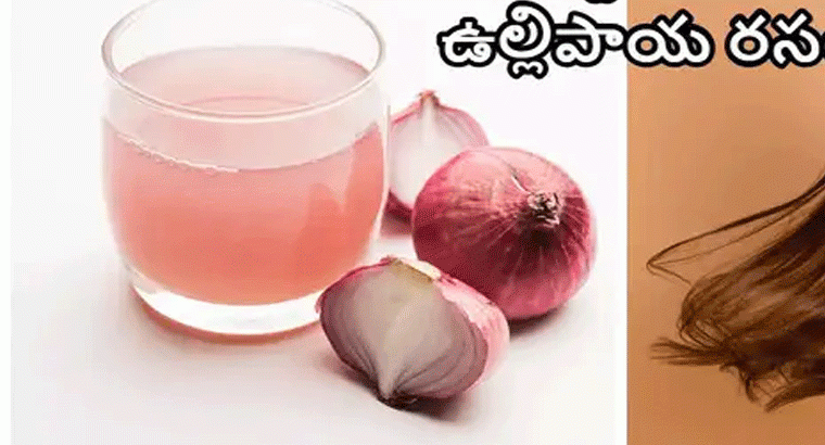 ఉల్లిరసంలో వీటిని కలిపి రాస్తే జుట్టు రాలడం తగ్గడమే కాదు.. ఒత్తుగా అందంగా పెరుగుతుంది