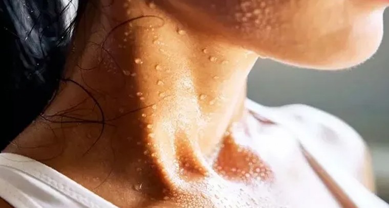 ఎక్కువ చెమట పట్టడం ఆరోగ్యానికి హానికరం
