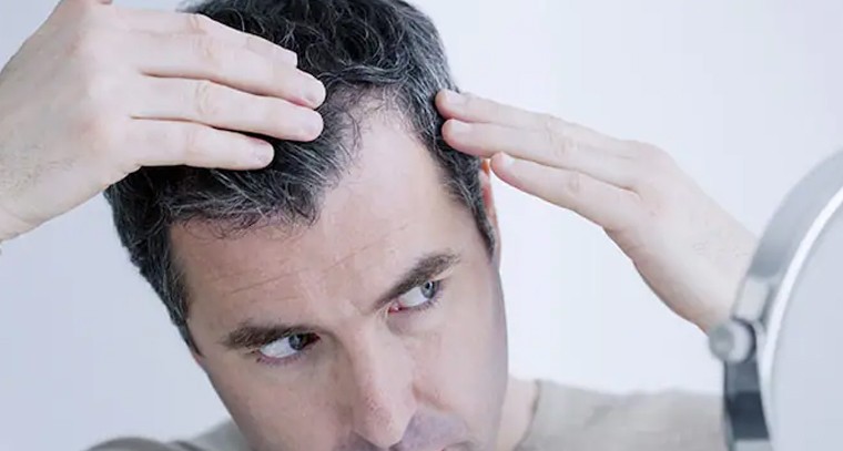 జుట్టు తెల్లబడకుండా ఉండేందుకు చేయండిలా
