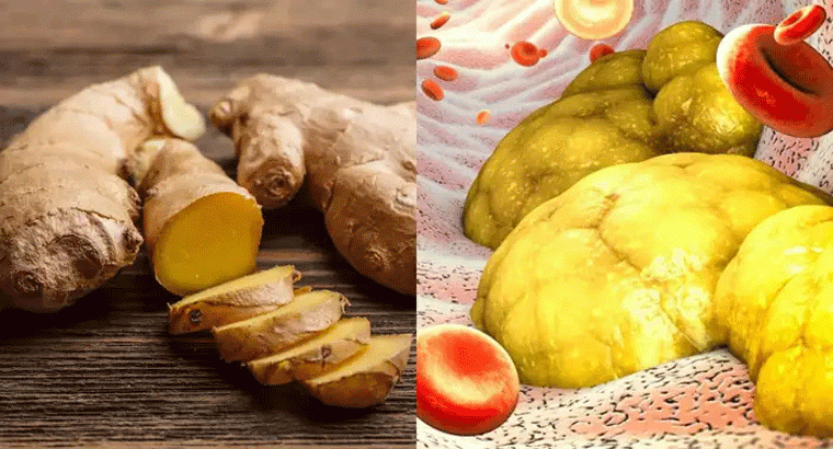 హాని చేసే కొలెస్ట్రాల్‌ని కరిగించే అల్లం, వీటిని తీసుకునే విధానం ఏంటో తెలుసా