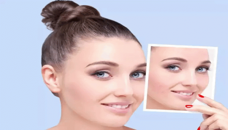 మొటిమలు మచ్చలు తగ్గాలంటే..ఇది ఎంతో అవసరం
