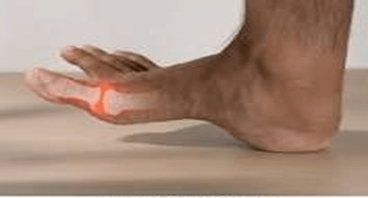 కీళ్లలో నిక్షిప్తమైన యూరిక్ యాసిడ్‌ని కరిగించి బయటకు పంపించే పండ్లు