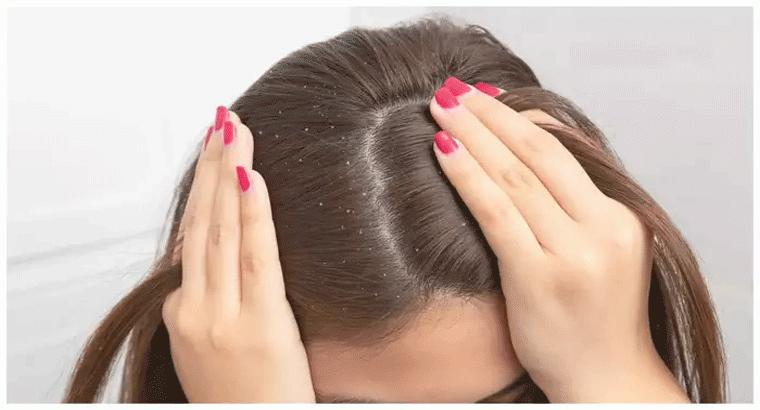 లవంగాల నీరు, ఎలా వాడితే జుట్టు ఒత్తుగా పెరుగుతుంది