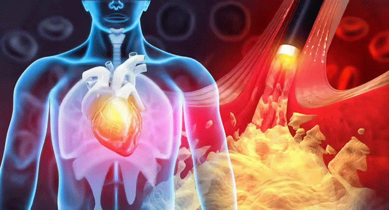 కొలెస్ట్రాల్ +హై బీపీ + షుగర్ మూడింటికీ ఒక టీ స్పూన్ ధనియాలు చాలు