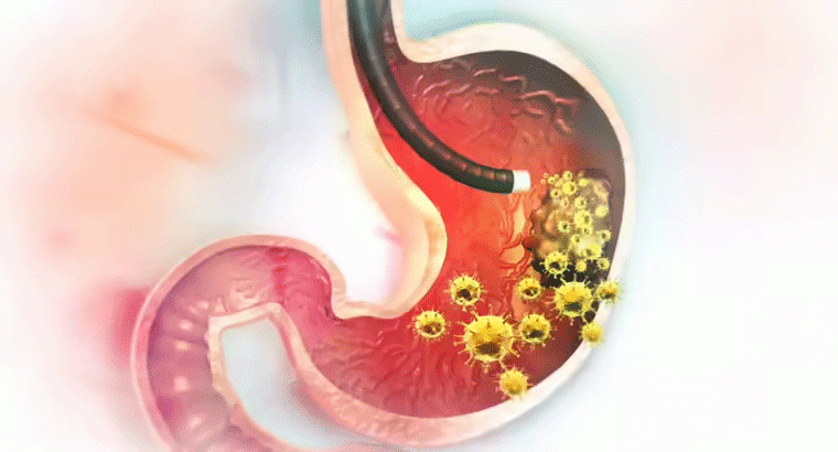 కొలెస్ట్రాల్ + షుగర్ + అధిక బరువు అన్నింటికి అల్లం ముక్క చాలు