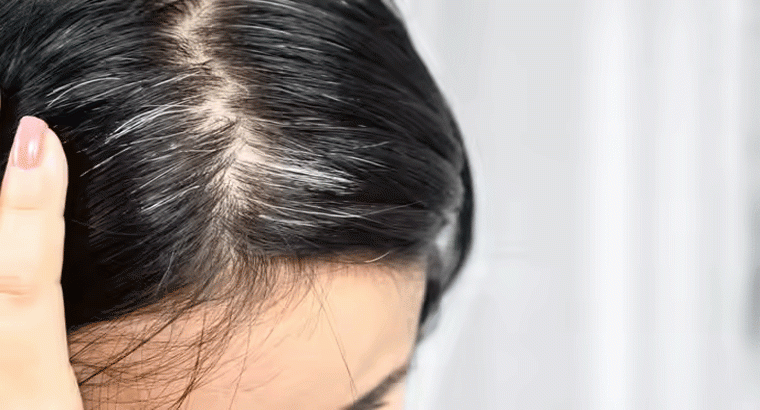 ఇది ఫాలో అయితే తెల్ల జుట్టు కాస్తా నల్లగా మారుతుంది