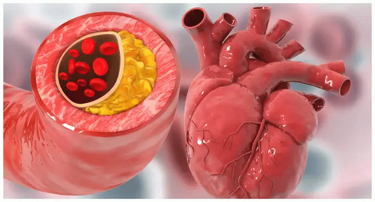 బాడీలోని చెడు కొలెస్ట్రాల్‌ని మూలాలతో సహా కరిగించే టమాట చట్నీ