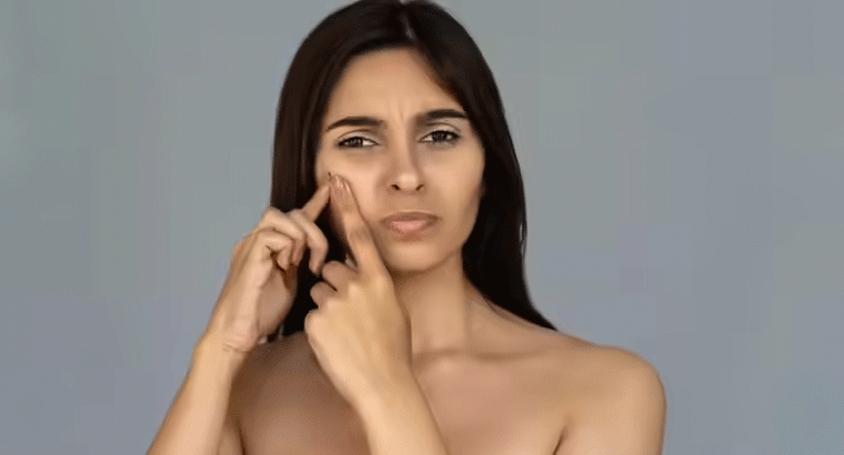 ముఖం మీద ఉన్న మొటిమలు తగ్గేందుకు ఏం తినాలి