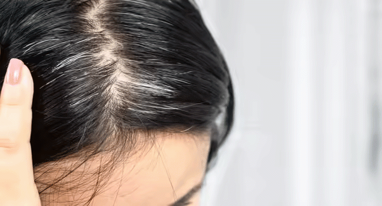 ఇంట్లోనే తెల్ల జుట్టును నల్లగా మార్చే సింపుల్ చిట్కా 