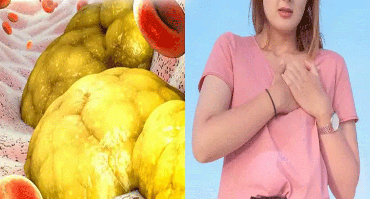 ఈ అలవాట్లు ఉంటే వెంటనే మానేయండి.. లేదంటే కొలెస్ట్రాల్ పెరిగి మీ గుండె ప్రమాదంలో పడుతుంది