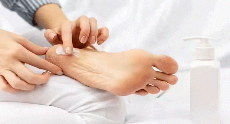 రెండు చెంచాల పాలతో.... పగిలిన మడమలు మృదువుగా మారతాయి