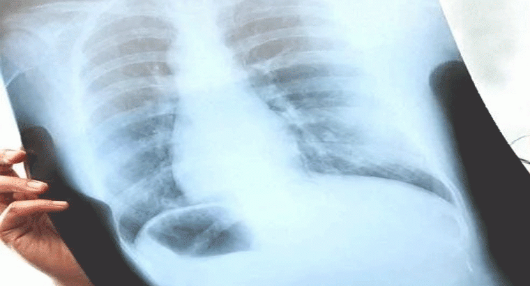 అదిి చూస్తే చాలు మీ వ్యాధి నిర్ధారణ అయిపోతుంది
