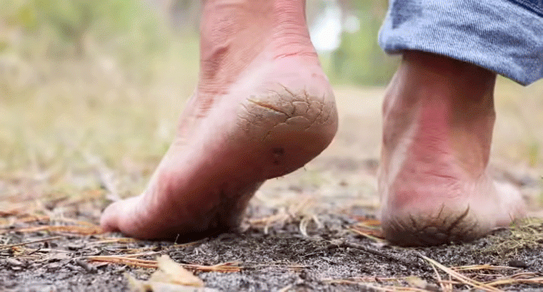 కాళ్ల నొప్పులు, పగుళ్లు ఇబ్బందా...అయితే ఈ చెప్పులు వేసుకోండి