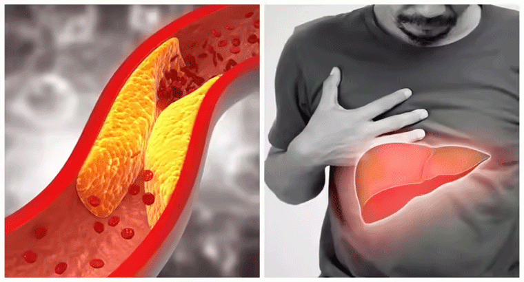 చెడు కొలెస్ట్రాల్, ట్రైగ్లిజరైడ్స్, ఫ్యాటీ లివర్ మూడు సమస్యలకి ఒకే పరిష్కారం