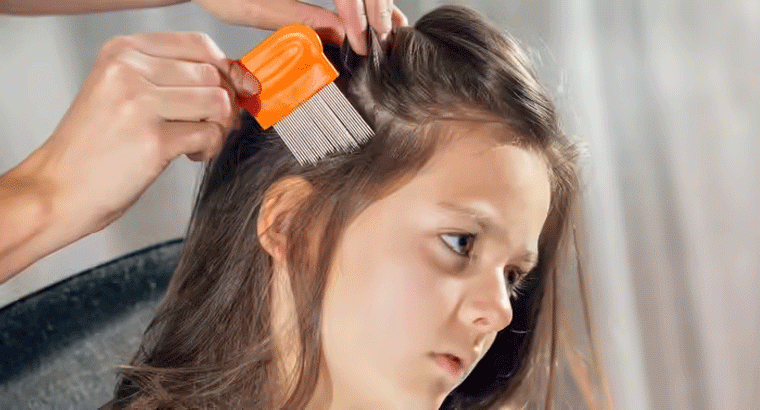 తలలో పేలు పడ్డాయా, ఈ చిట్కాతో అన్నీ మాయం